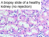 Biopsy slide of a healthy kidney